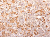 Staining with Mouse Monclonal ACTH [Clone 57] Antibody in formalin-fixed paraffin-embedded human pituitary gland.